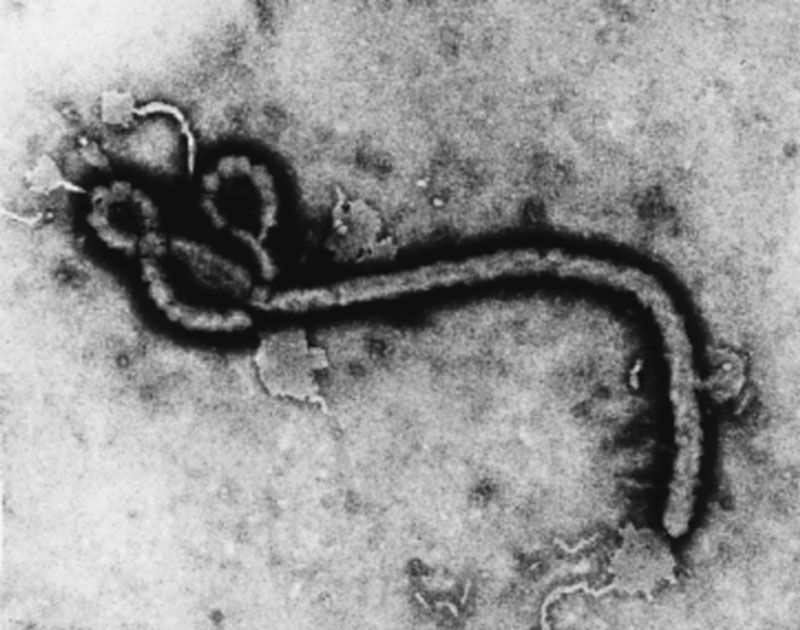 Imagen del virus ébola al microscopio